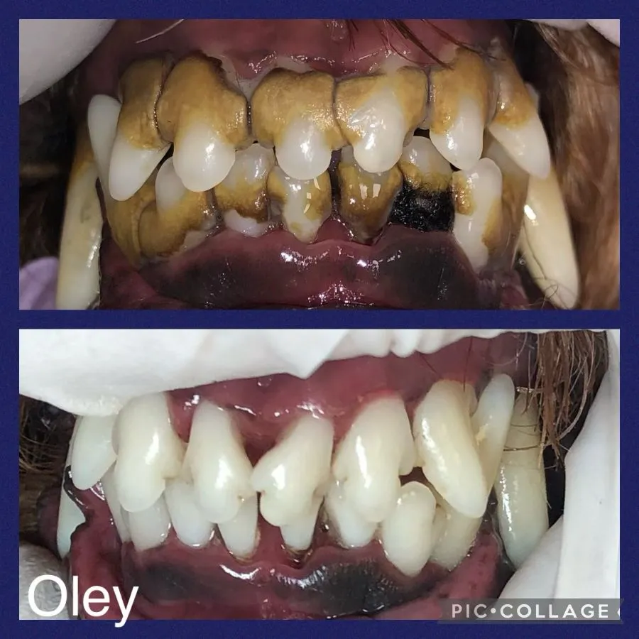 Teeth Cleaning for Cats and Dogs Cosmetic